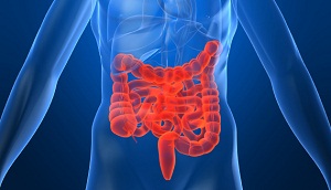 Irritable Bowel Syndrome